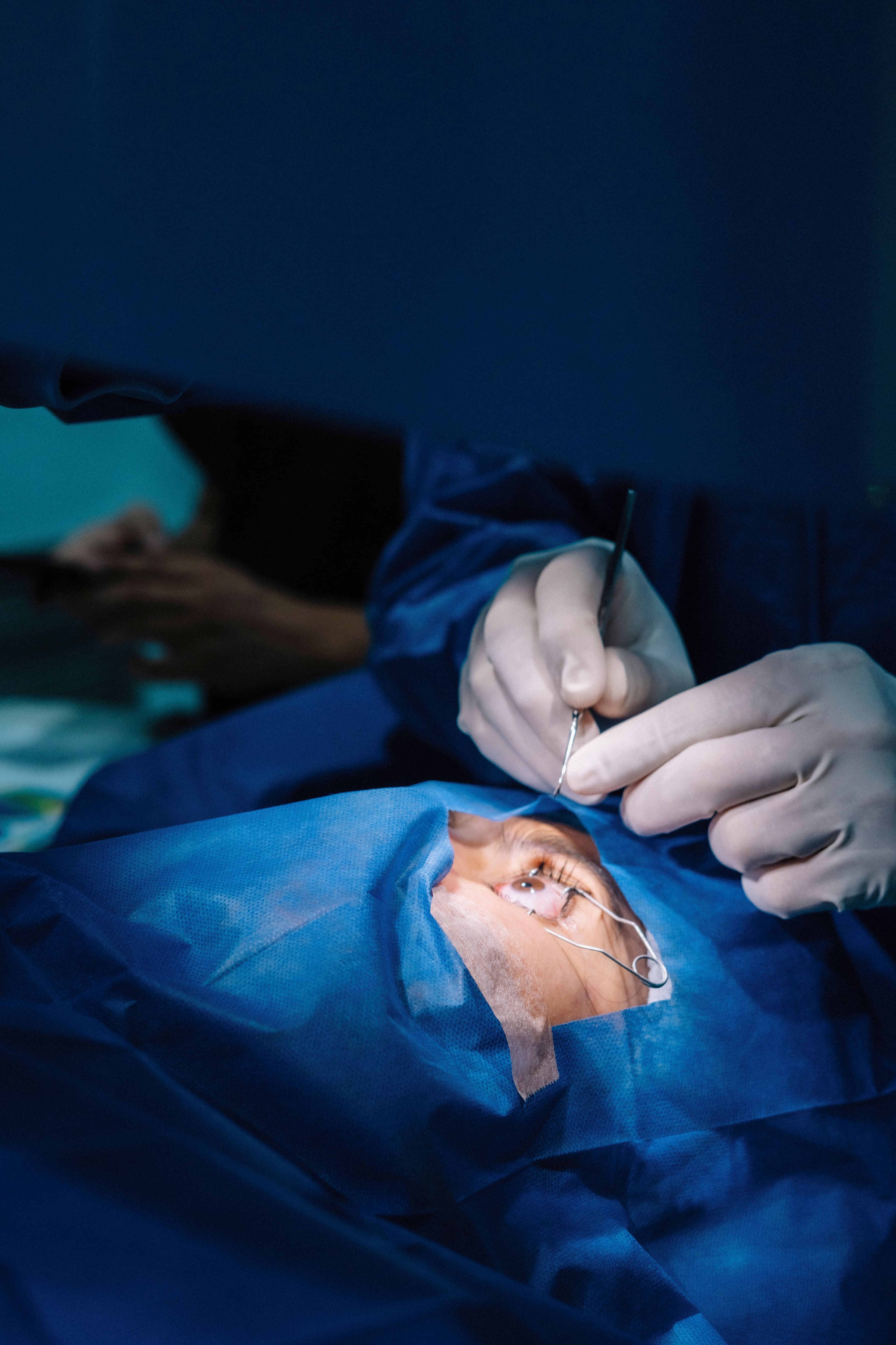Eye Surgery
