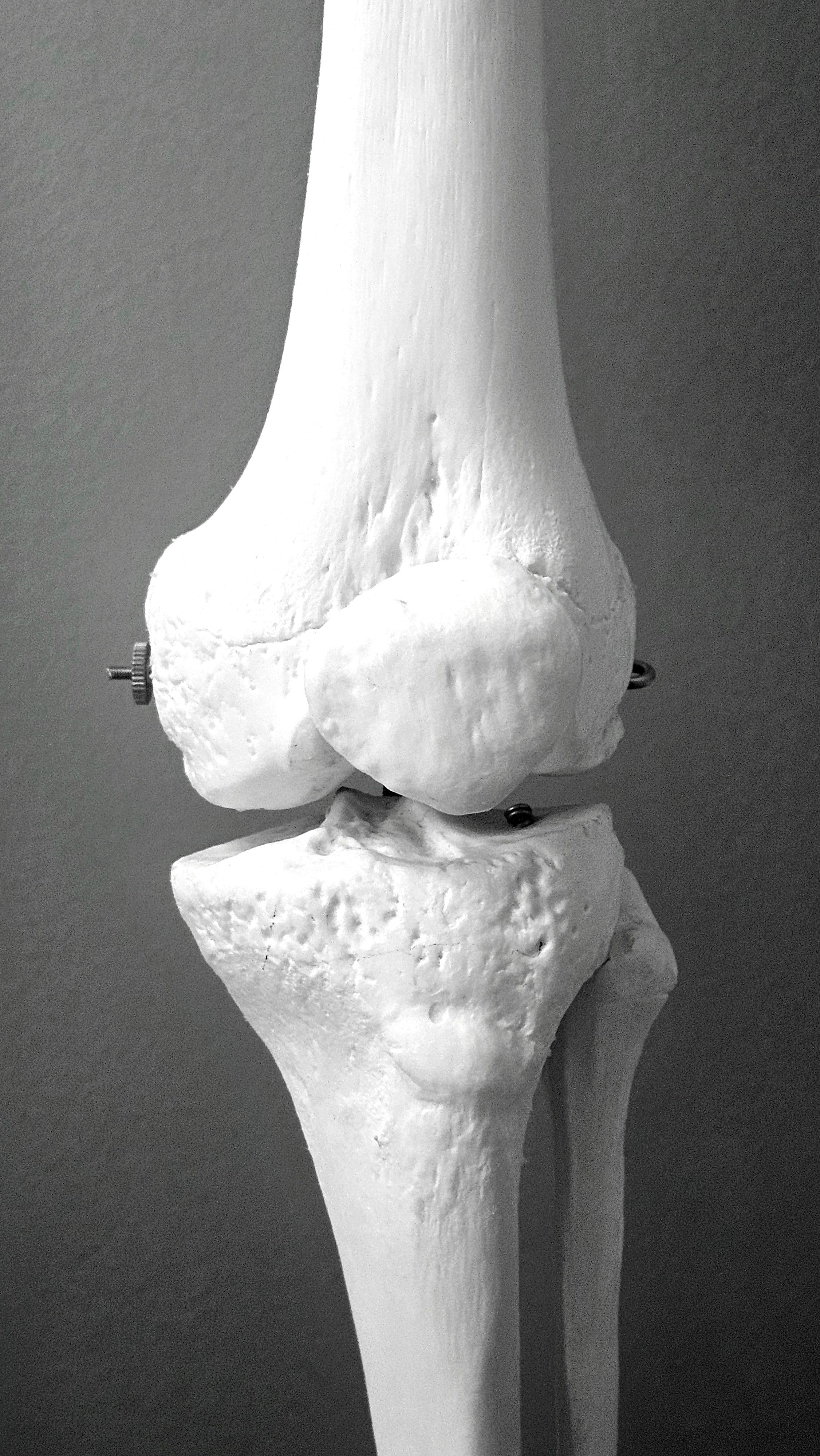 Orthopedics
